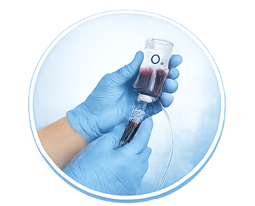 Major otohemoterapi Kuşadası